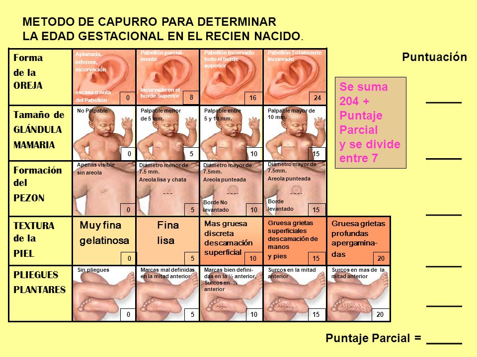 capurro edad gestacional